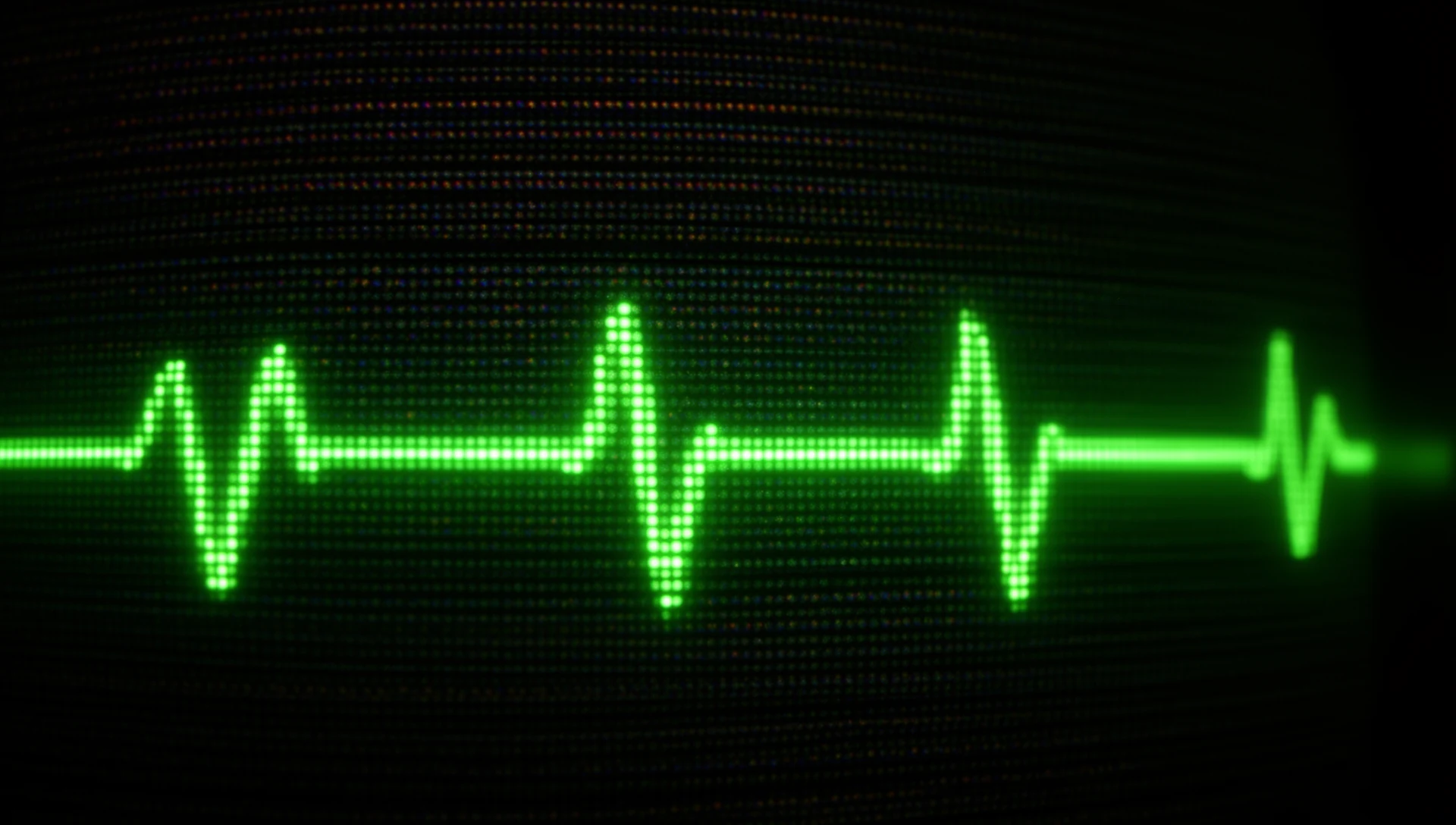 The pulse in phosphor dots, macro